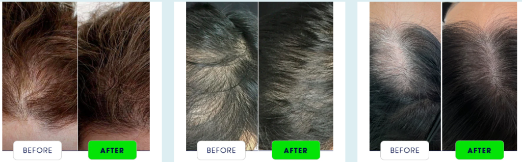 havelyn|
havelyn hair food oil|
havelyn hair oil|
havelyn oil|
havelyn food oil