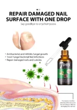 Best Nail Fungus Serum Price in Pakistan – 7 Day Treatment (30ml) - Image 5
